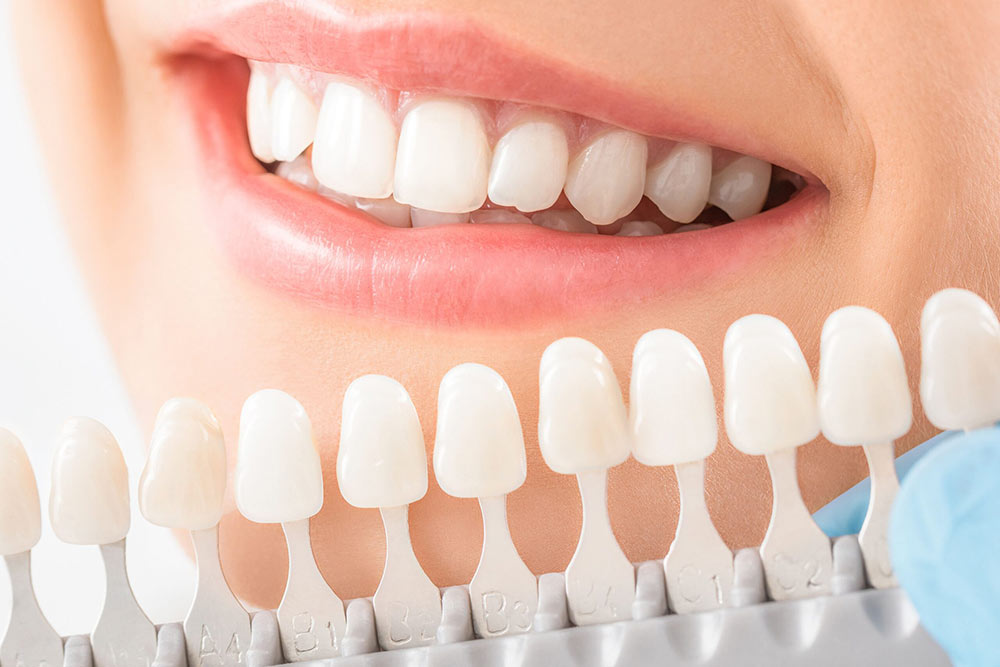 Healthy white smile